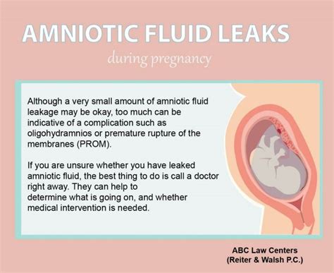 amniotic fluid sticky|Leaking Amniotic Fluid: How to Tell